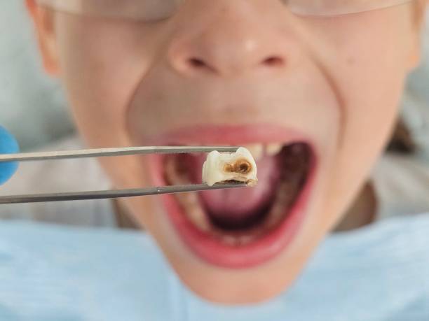Best Pediatric Emergency Dentist in Pleasant Run Farm, OH